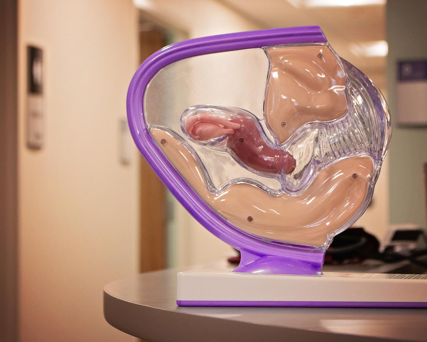 Uterus Display