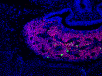 Image: E15 mouse pituitary with immunofluorescent staining