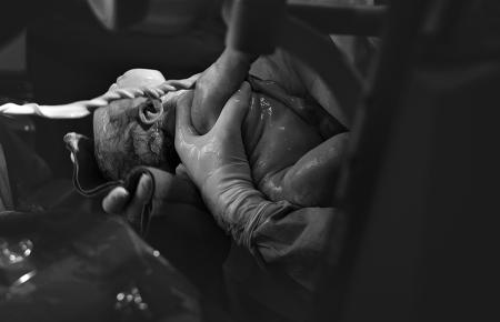 baby being born